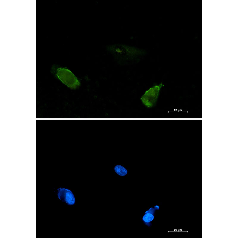 BIN1 Rabbit mAb