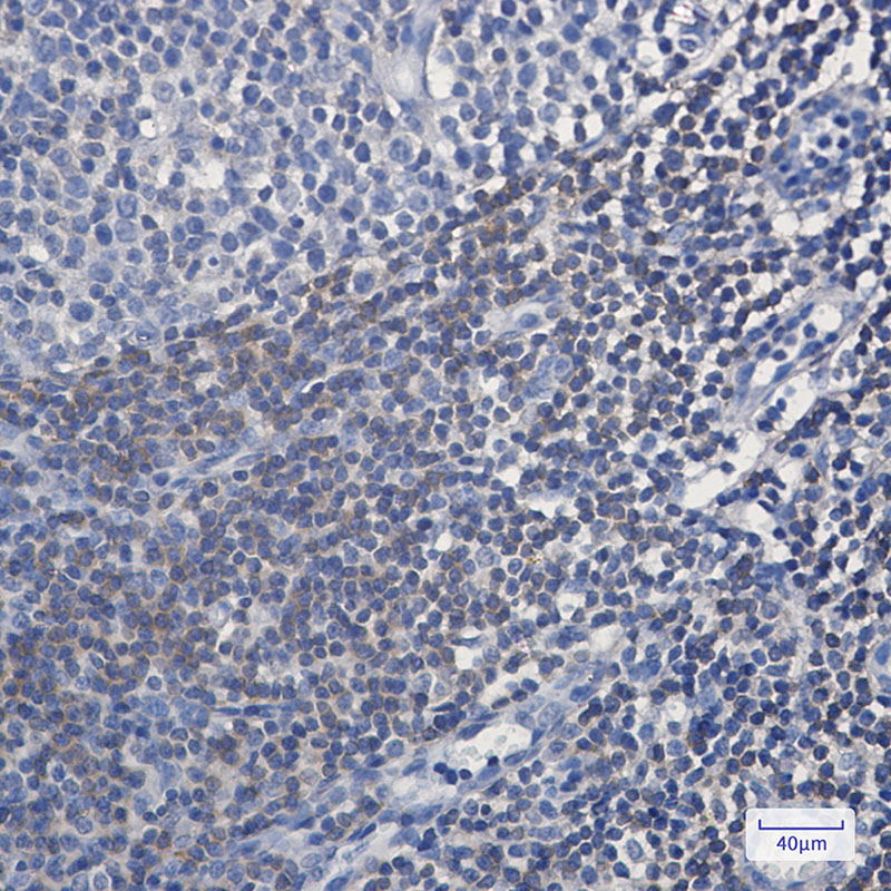 BIN1 Rabbit mAb