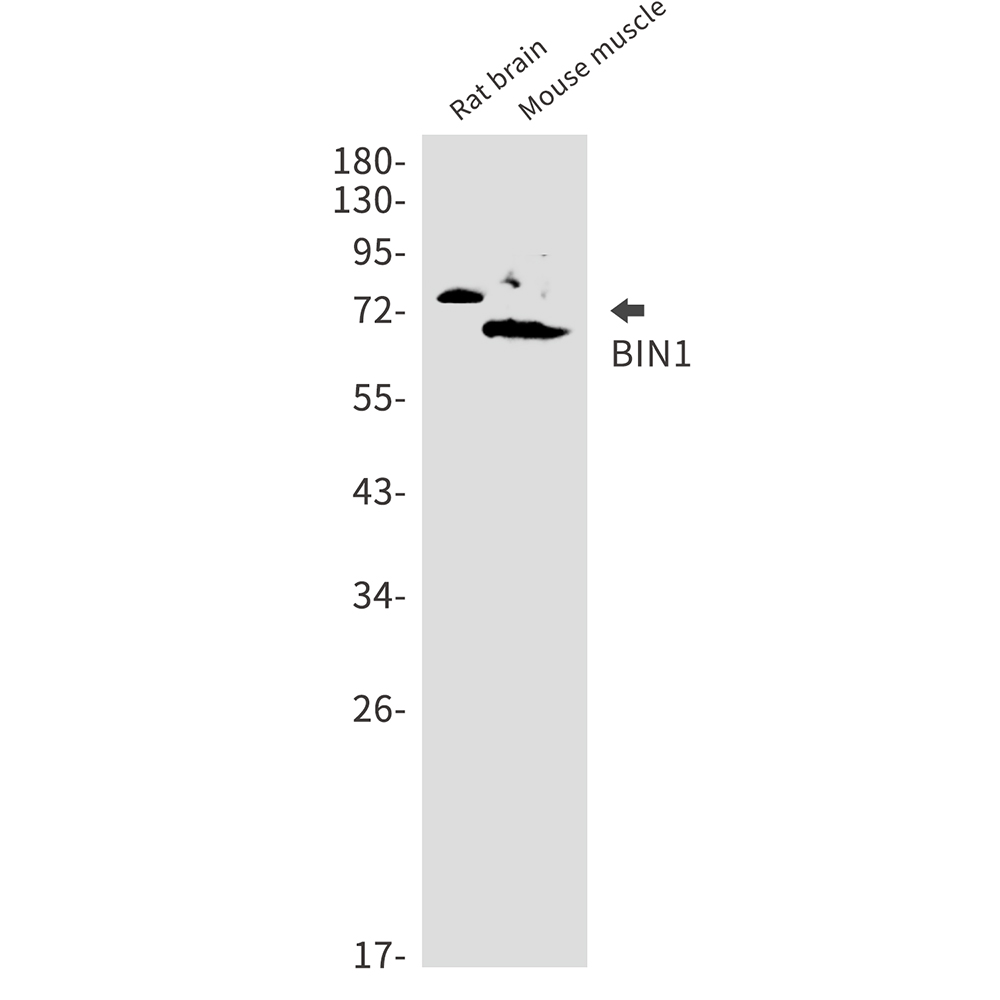 BIN1 Rabbit mAb
