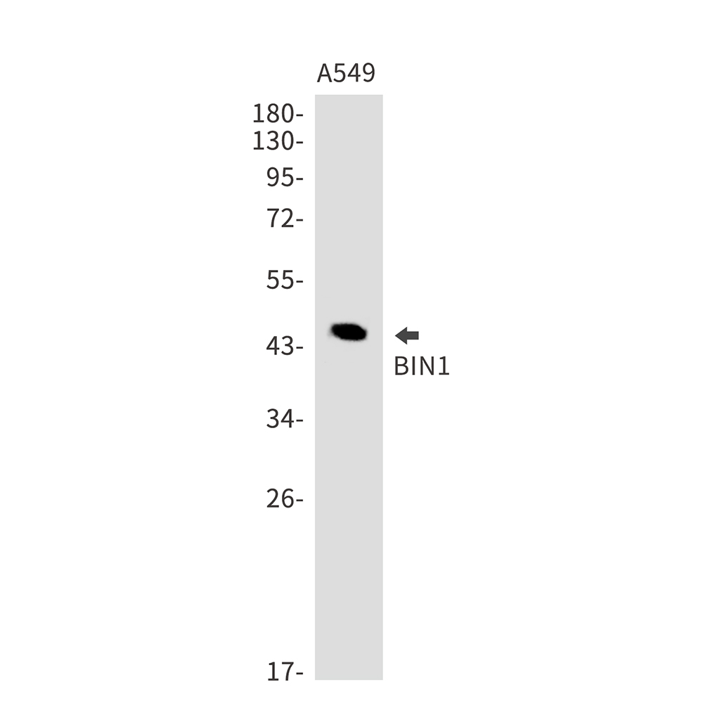 BIN1 Rabbit mAb