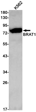 BRAT1 Rabbit mAb
