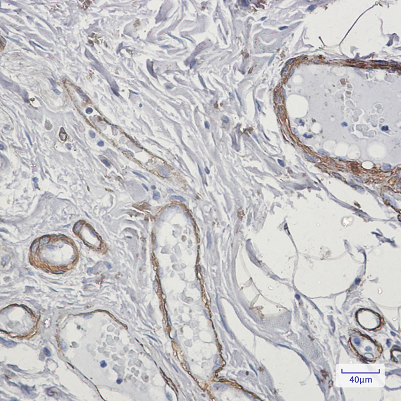 Caldesmon Rabbit mAb