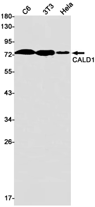 Caldesmon Rabbit mAb