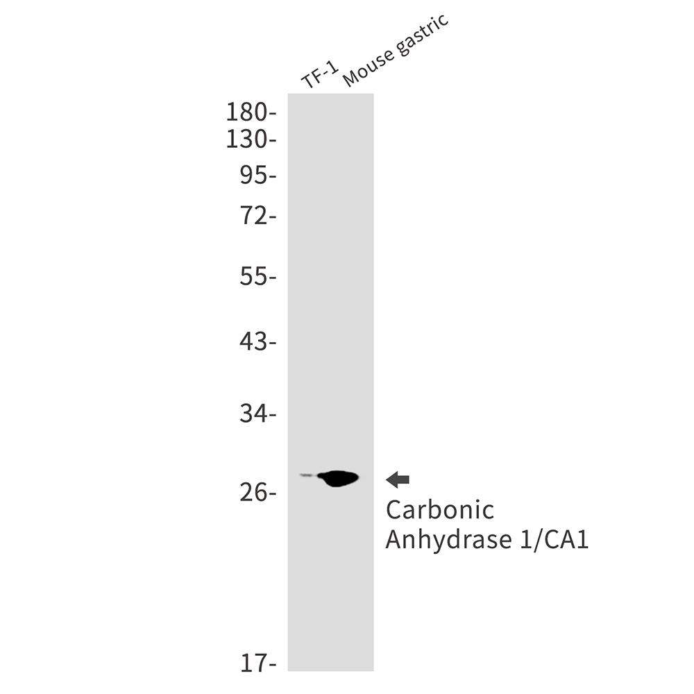 Carbonic Anhydrase 1 Rabbit mAb