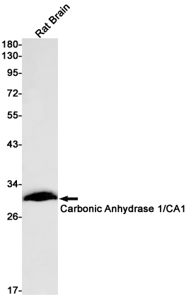 Carbonic Anhydrase 1 Rabbit mAb