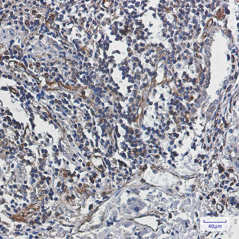 Caspase 10 Rabbit mAb