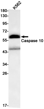 Caspase 10 Rabbit mAb