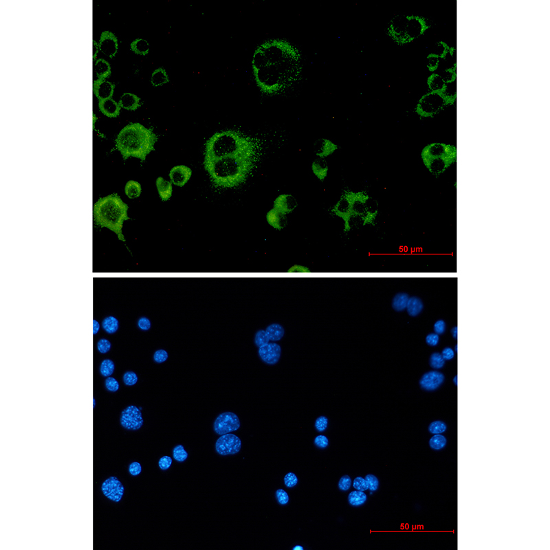 Catalase Rabbit mAb