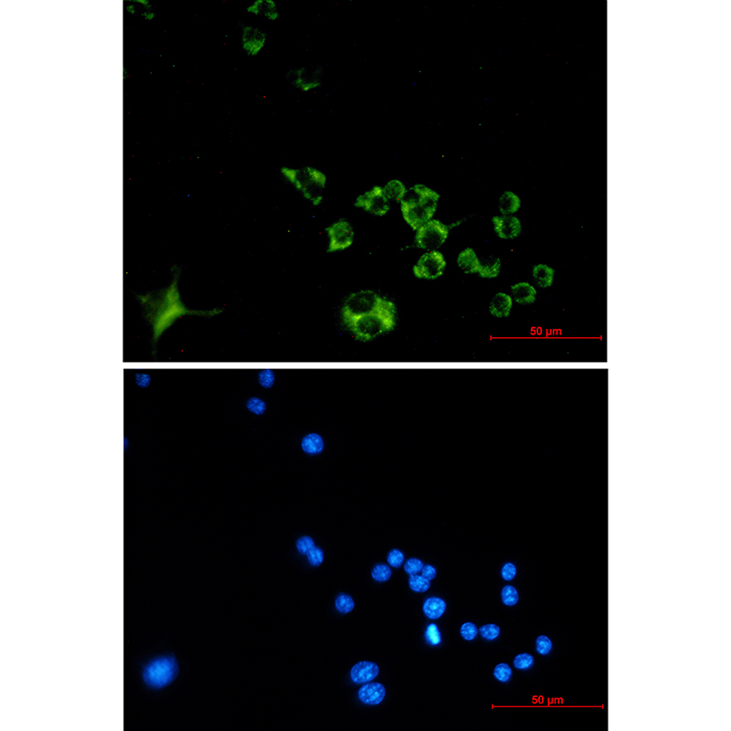 Cathepsin B Rabbit mAb