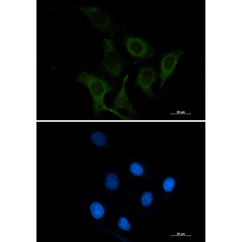 CD166 Rabbit mAb
