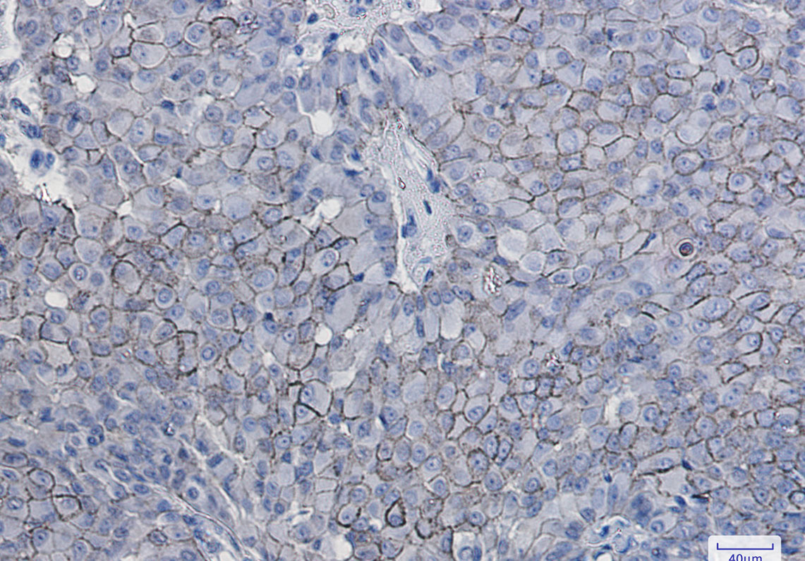 CD166 Rabbit mAb