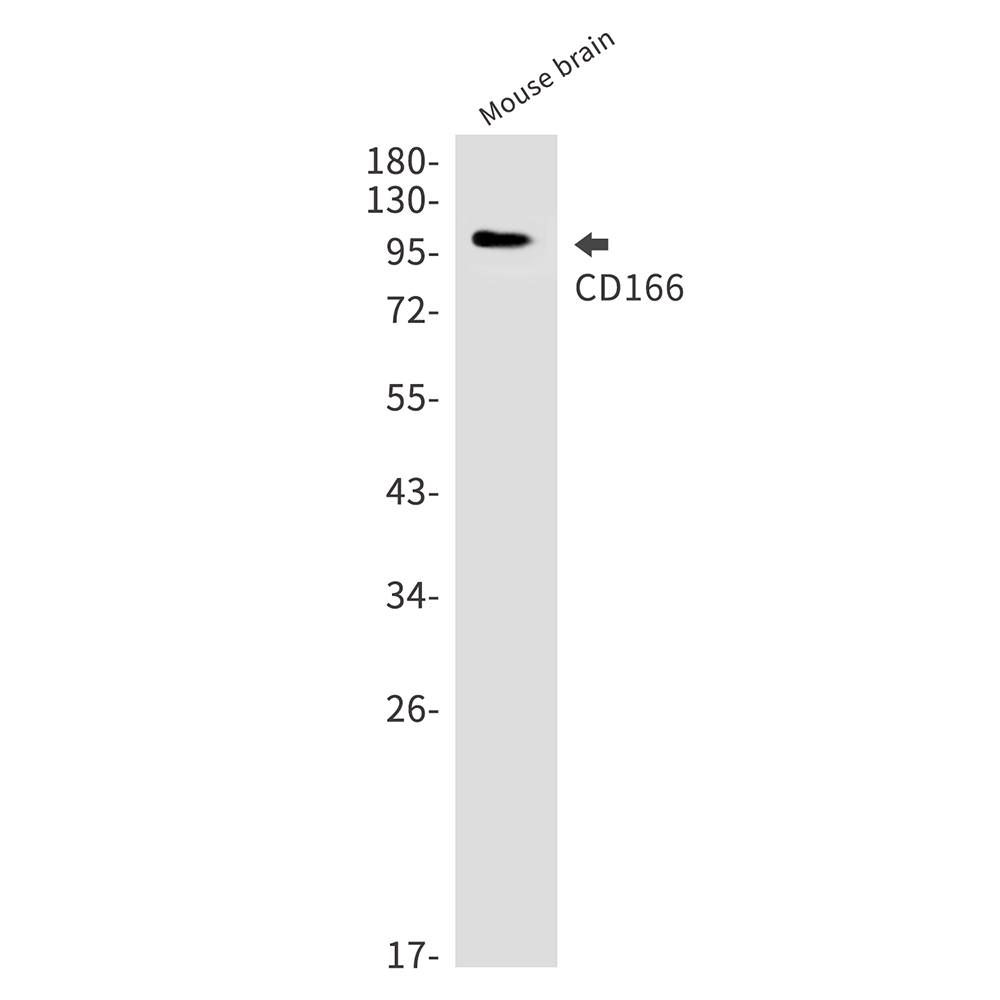 CD166 Rabbit mAb