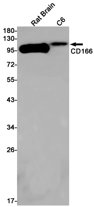 CD166 Rabbit mAb