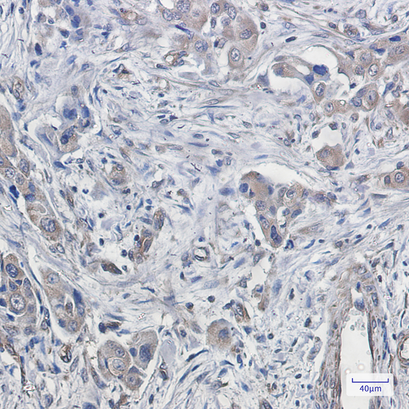 CDT2 Rabbit mAb