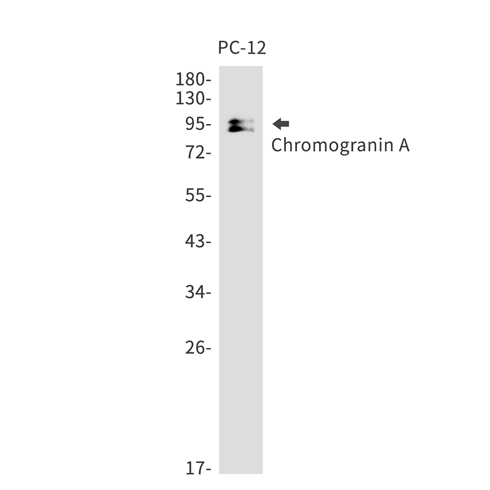 Chromogranin A Rabbit mAb