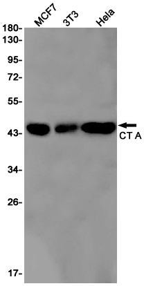 CT A Rabbit mAb
