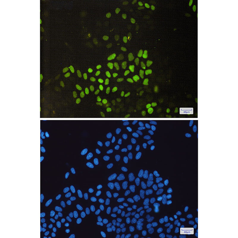 Cyclin E2 Rabbit mAb