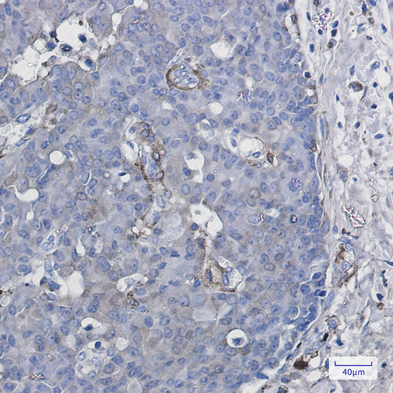 Cytochrome P450 1B1 Rabbit mAb