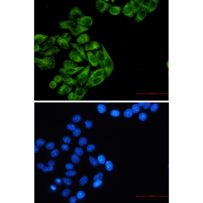 Cytokeratin 7 Rabbit mAb