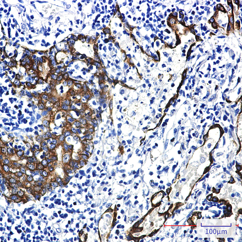 Cytokeratin 7 Rabbit mAb