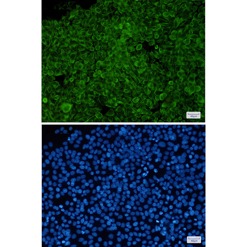 Phospho-Cytokeratin 8 (Ser23) Rabbit mAb