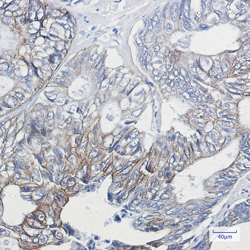 Phospho-Cytokeratin 8 (Ser23) Rabbit mAb