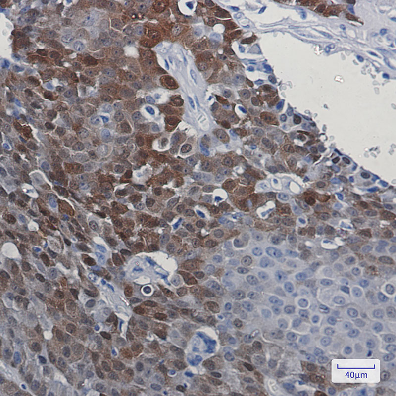 DARPP32 Rabbit mAb