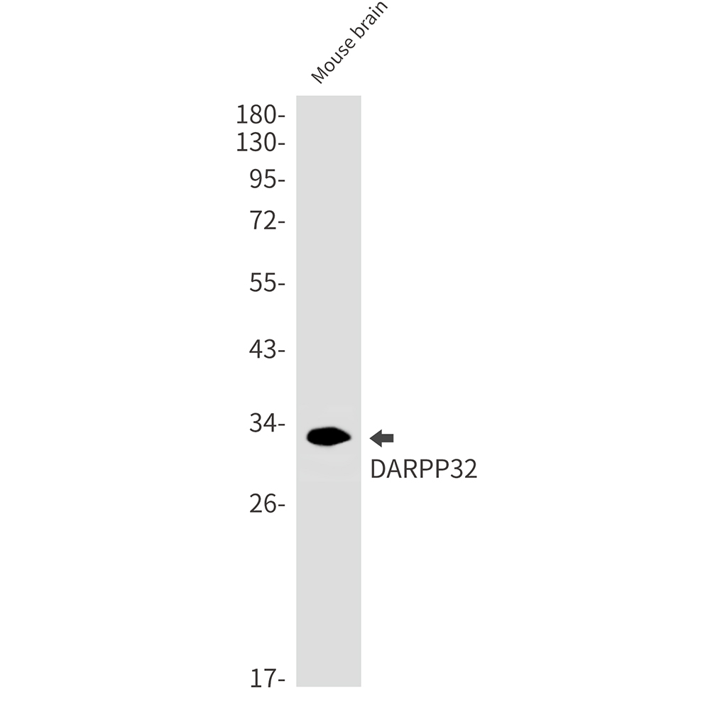 DARPP32 Rabbit mAb