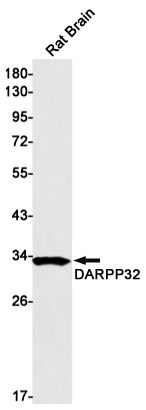 DARPP32 Rabbit mAb