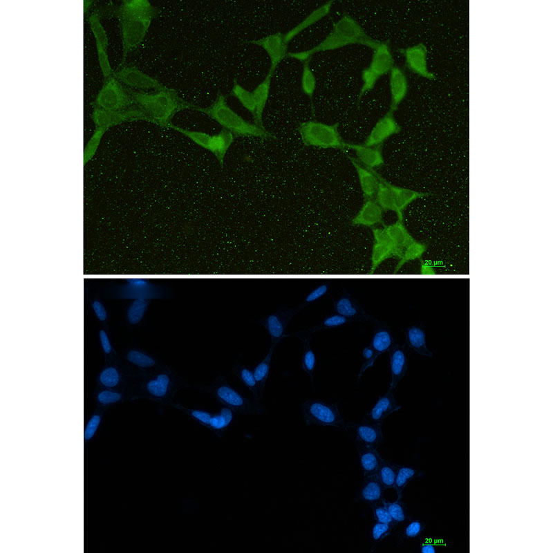 DDX21 Rabbit mAb