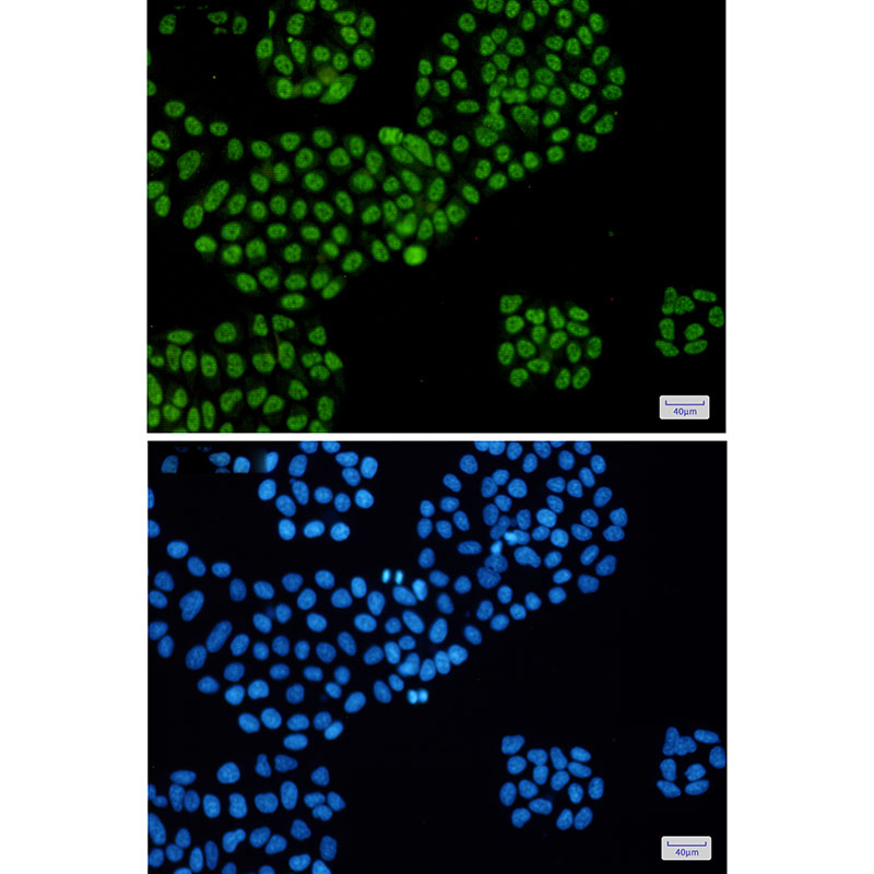 DDX5 Rabbit mAb