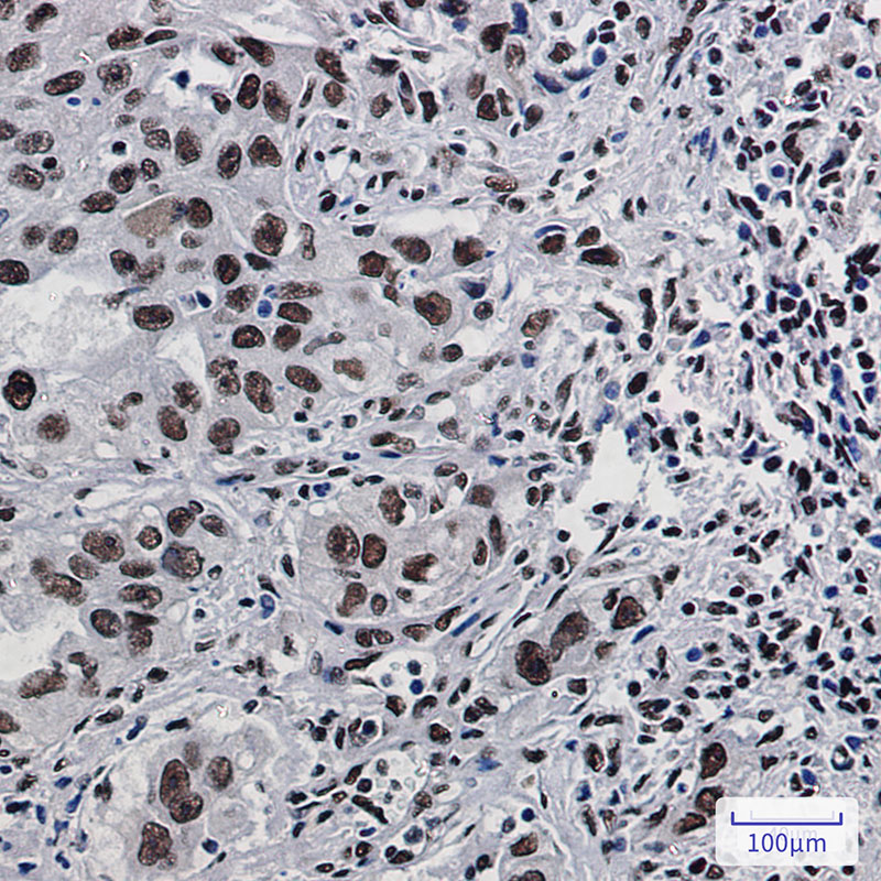 DDX5 Rabbit mAb