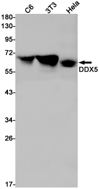 DDX5 Rabbit mAb