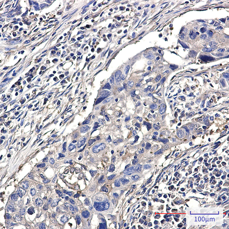 Destrin Rabbit mAb
