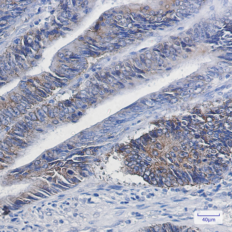 DGAT1 Rabbit mAb