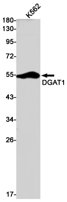 DGAT1 Rabbit mAb