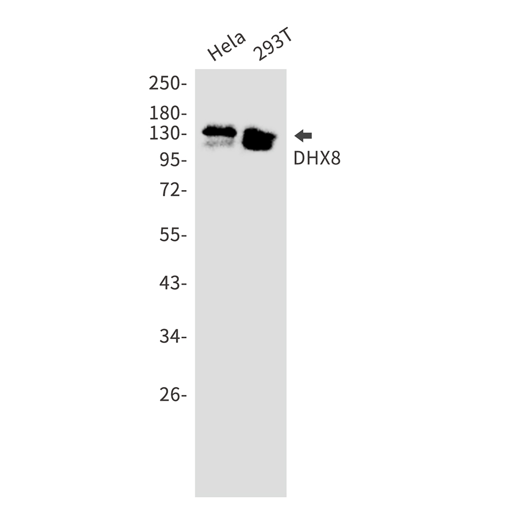 DHX8 Rabbit mAb