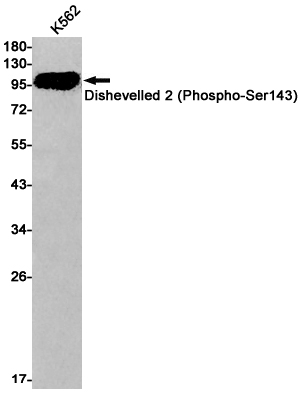 Phospho-Dishevelled 2 (Ser143) Rabbit mAb