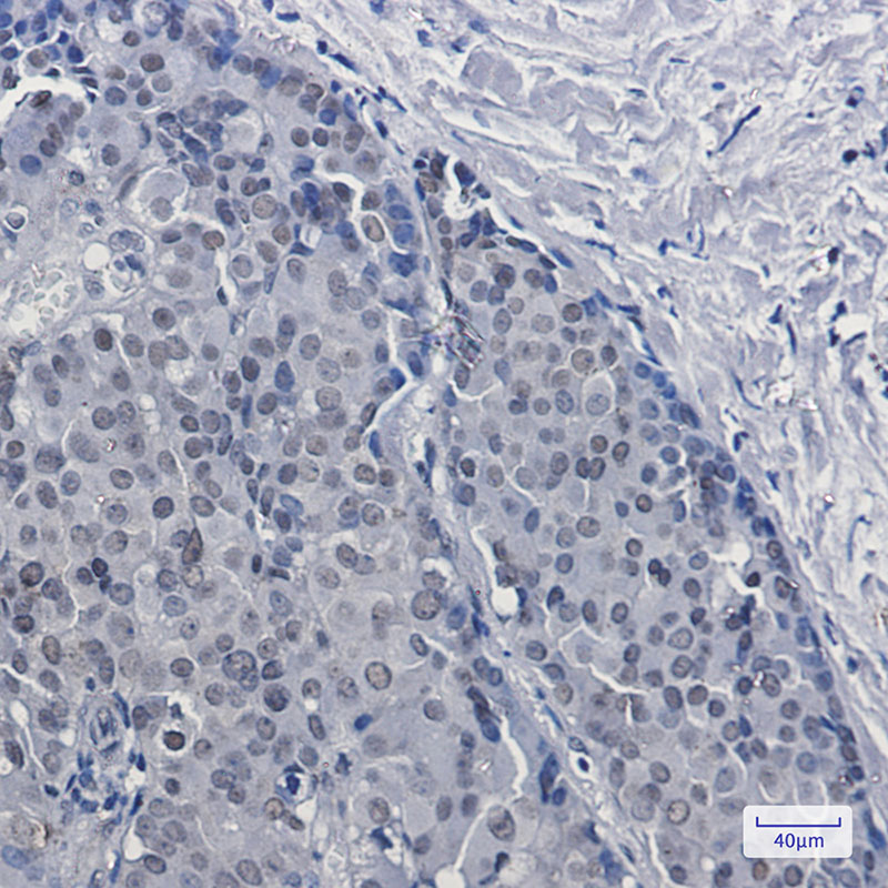 DKC1 Rabbit mAb