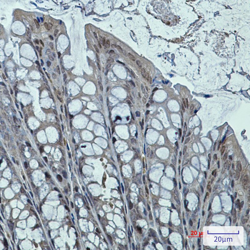 DNAJB6 Rabbit mAb