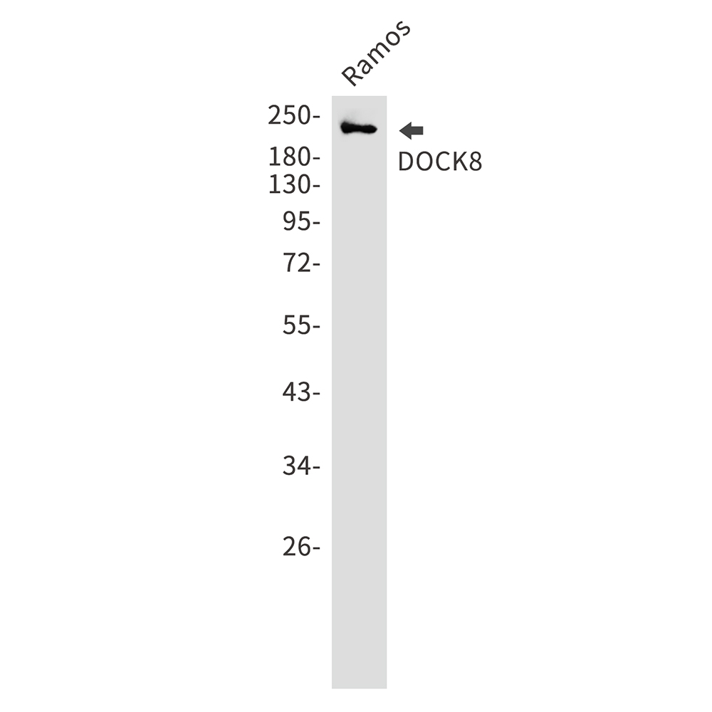 DOCK8 Rabbit mAb