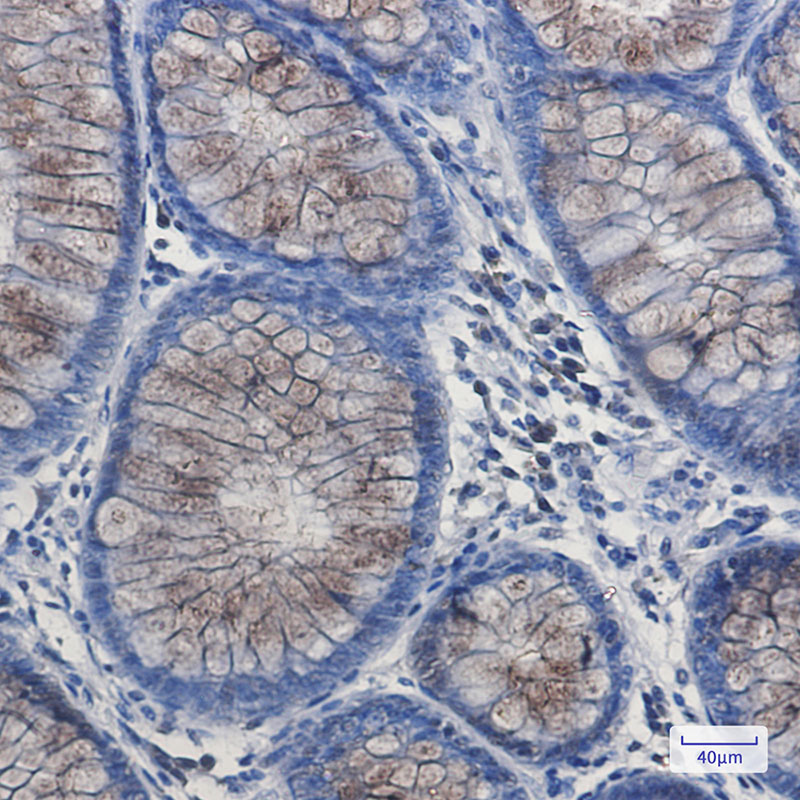 DYNLL1 Rabbit mAb
