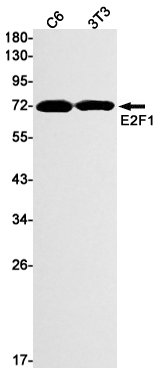 E2F1 Rabbit mAb