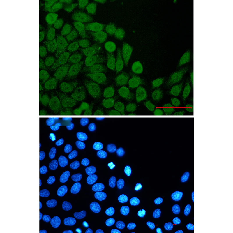 eIF4A3 Rabbit mAb