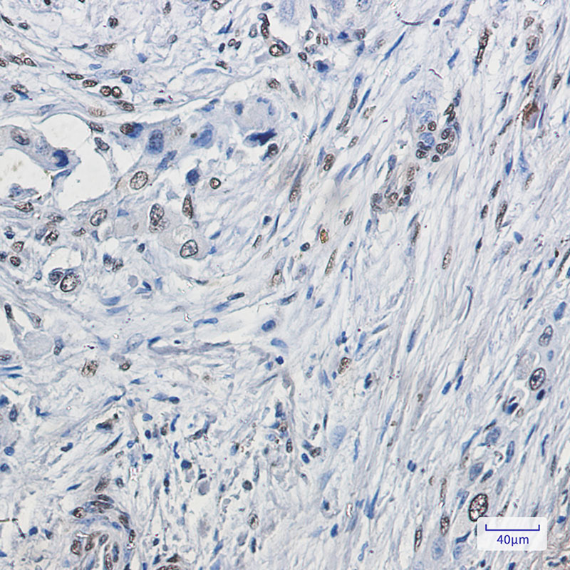 ELK1 Rabbit mAb