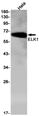 ELK1 Rabbit mAb