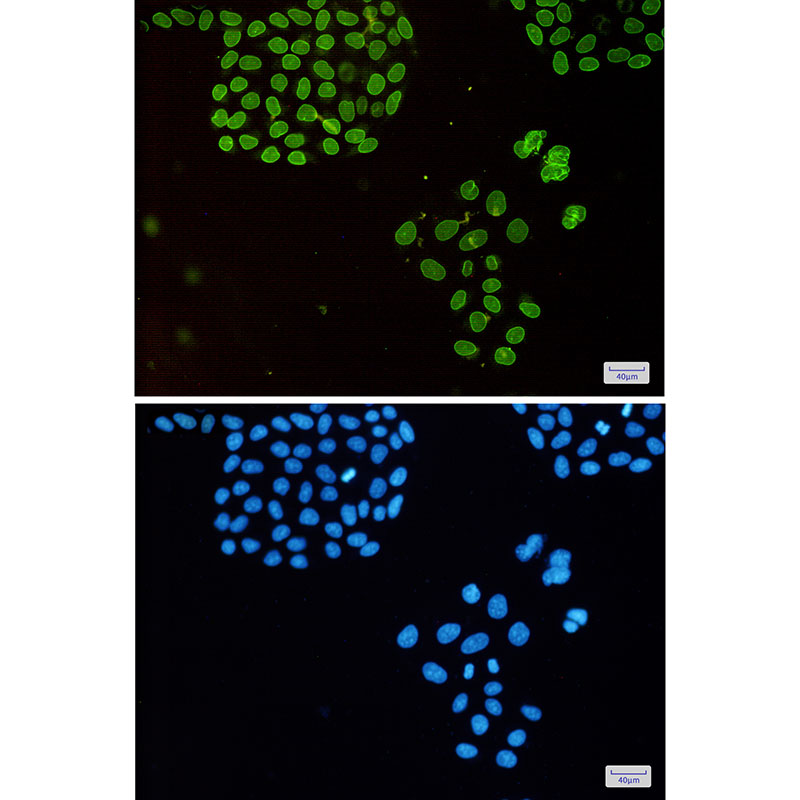 Emerin Rabbit mAb
