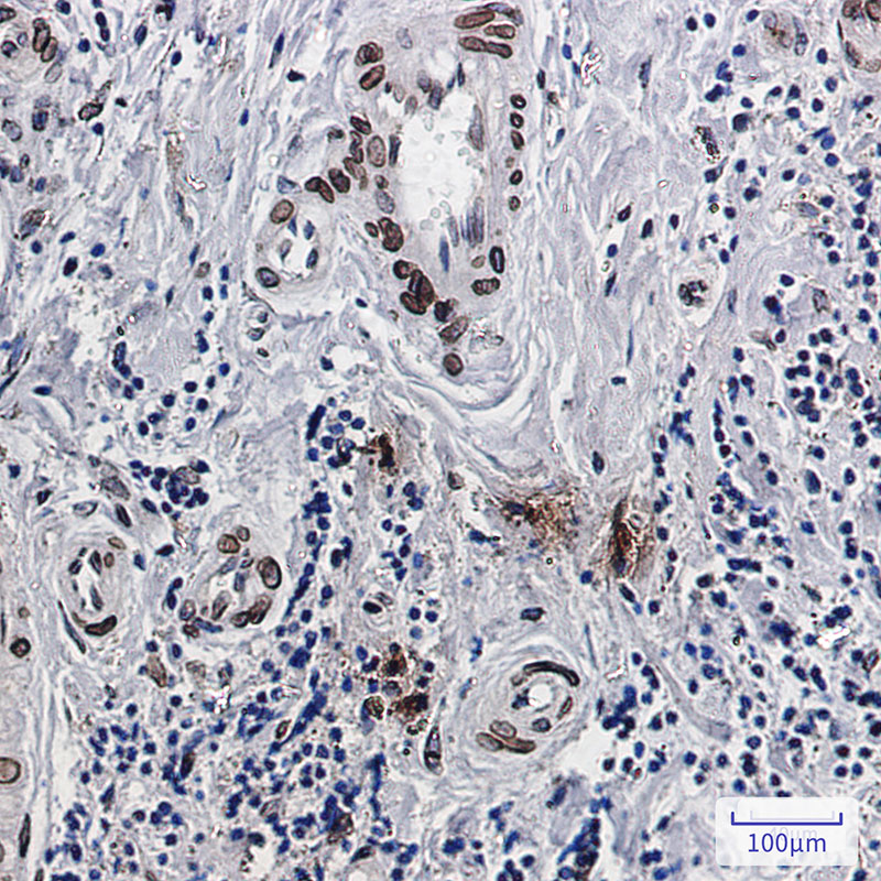 Emerin Rabbit mAb