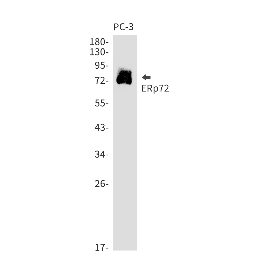 ERp72 Rabbit mAb