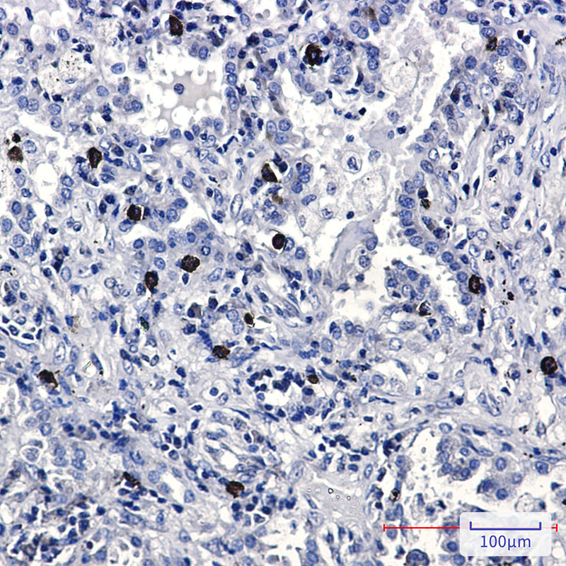 FLI1 Rabbit mAb
